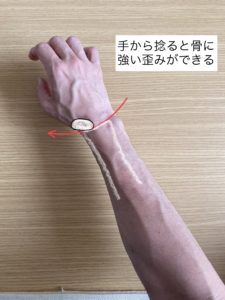 腱鞘炎のリスクを上げる手首の使い方